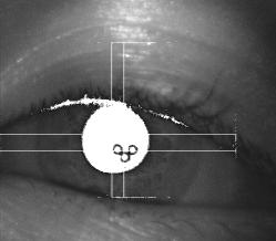 eyeTracking